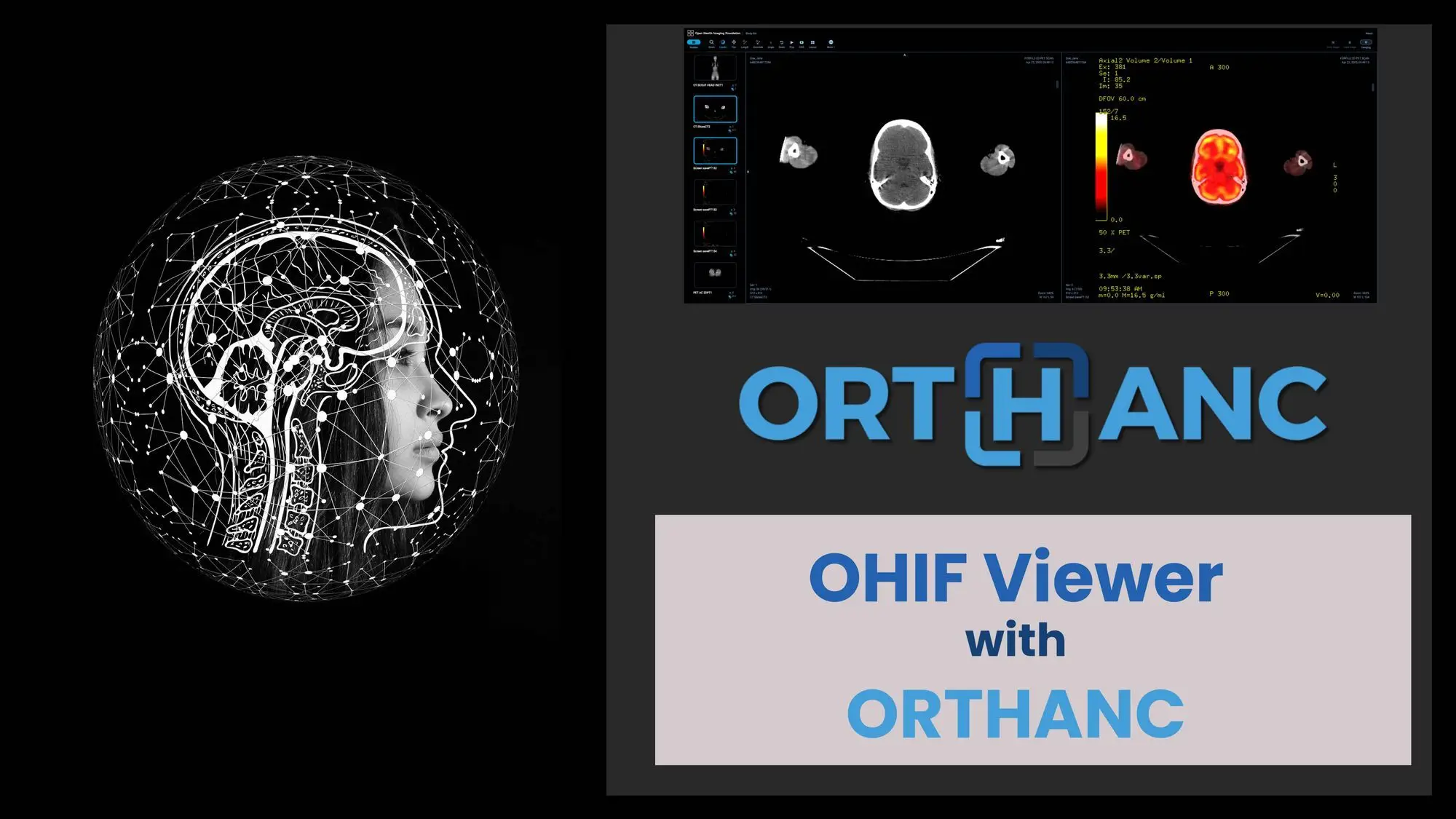 Dual Boot with Encryption